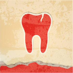 tooth with a crack retro poster